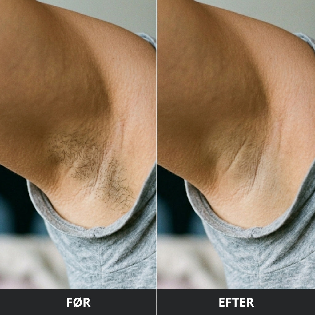 IPL Pro - Permanent hårfjerner